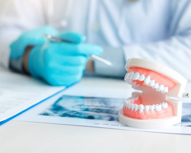 Model of dentures in Dudley on dentist's desk